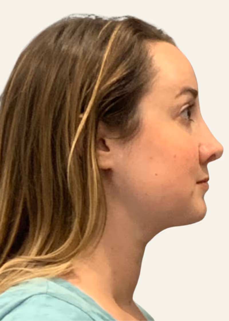 Case 2 view