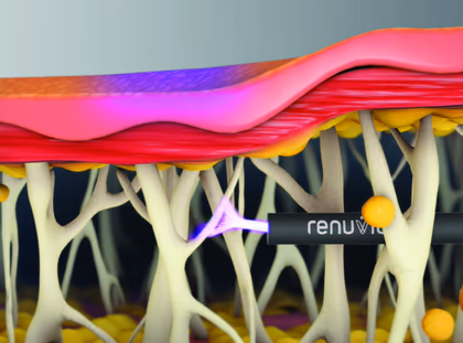 Radiofrequency (RF) Energy In Aesthetic Surgery
